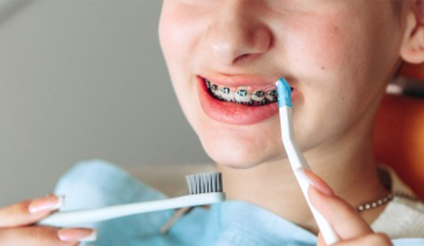 矯正治療中のケア