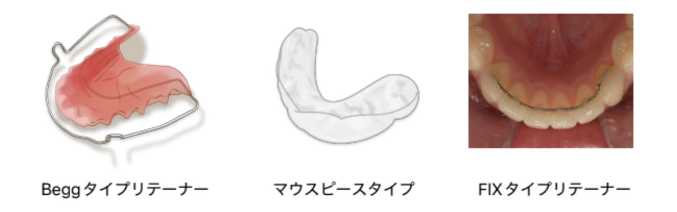 保定装置